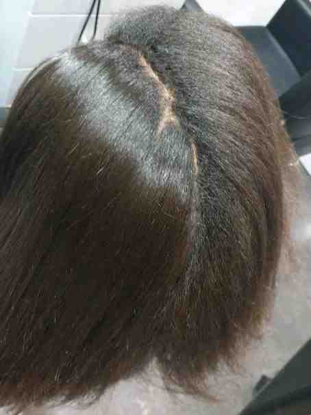 Soins capillaire antipelliculaire null null